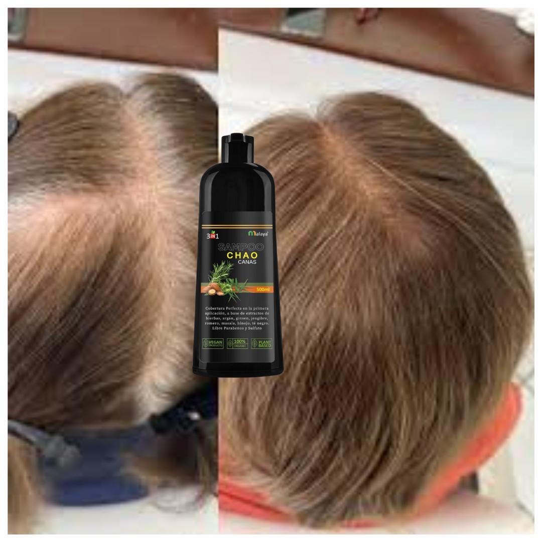 SHAMPOO CHAO CANAS + TRATAMIENTO