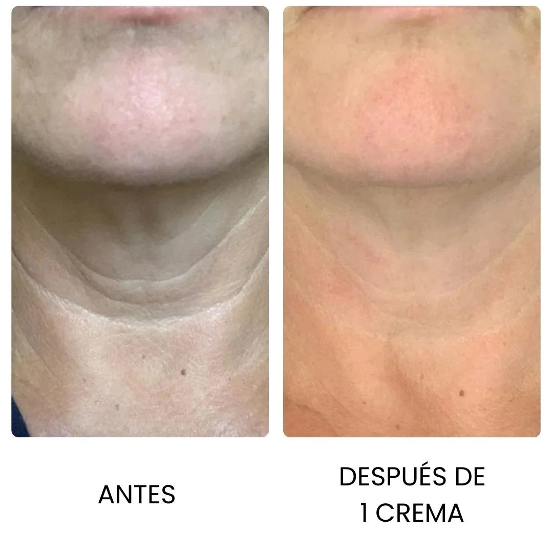 GOPURE™ 2X1 ✨  Crema Reafirmante Lifting Para El Cuello