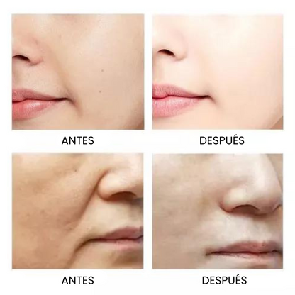 Ginseng™ 🫚 Sérum Rejuvenecedor Hidratante Con Raíz