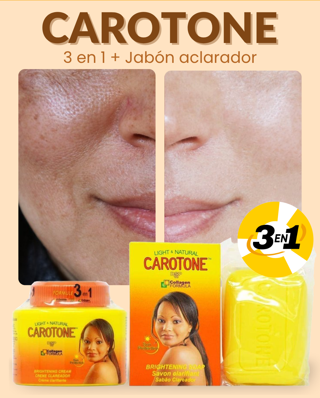 CAROTONE™ | Quita Manchas Crema + Jabón + Obsequio
