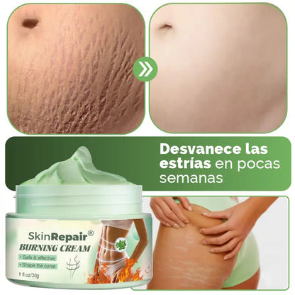 SkinRepair® 2X1 ✨  Crema Antiestrías y Anticelulitis