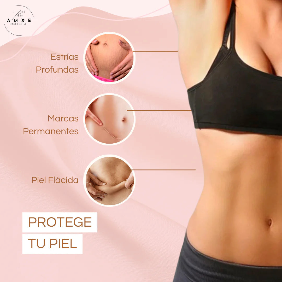 SkinRepair® 2X1 ✨  Crema Antiestrías y Anticelulitis