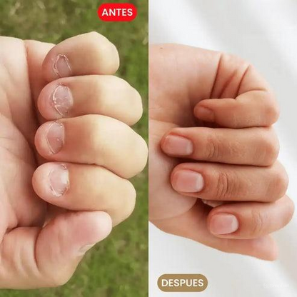 Tratamiento para evitar comerse las uñas 100% Natural🍃
